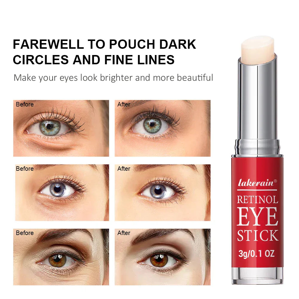 Retinol Eye Cream Stick